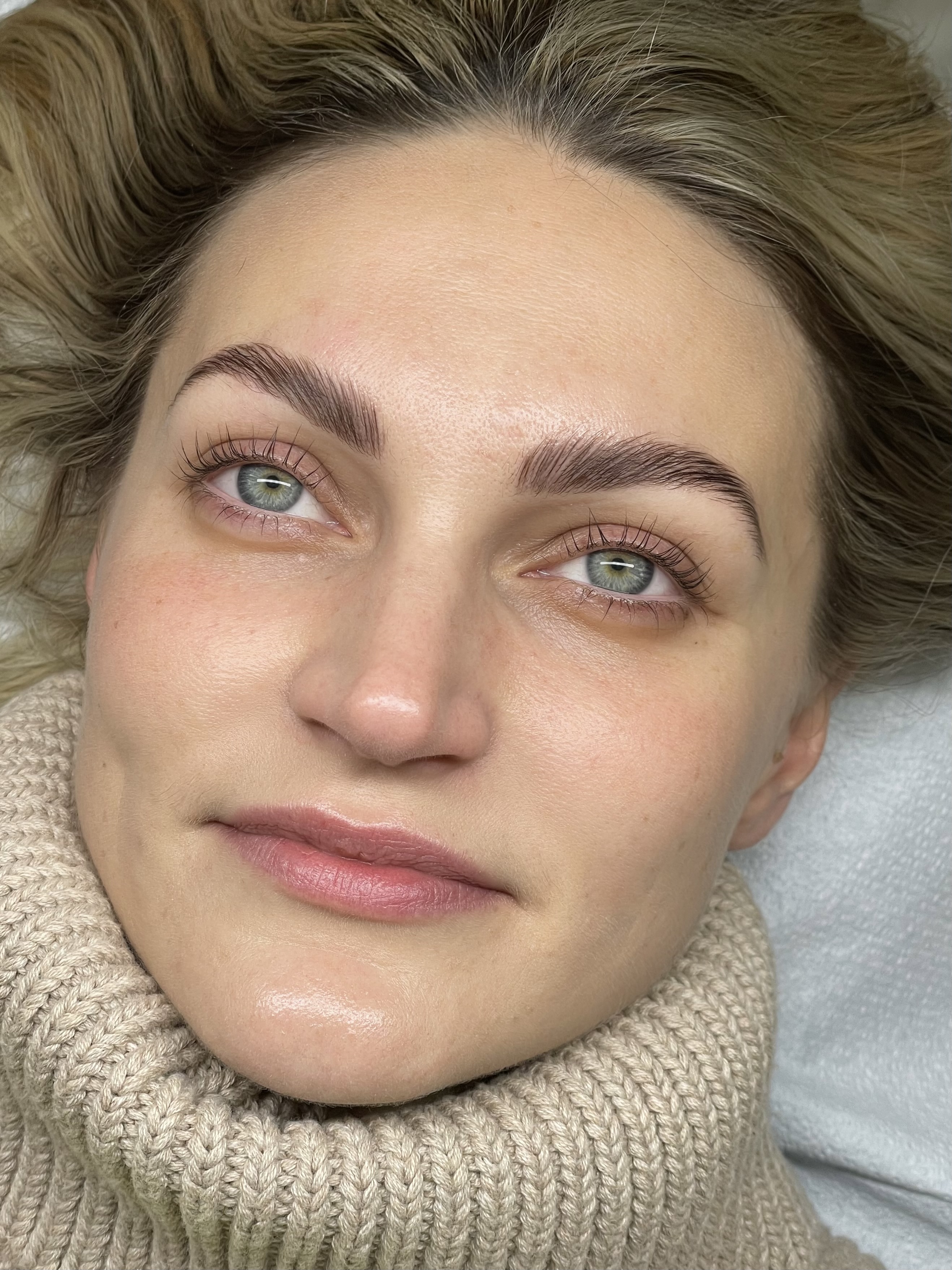 Brow lift and tint result, healed