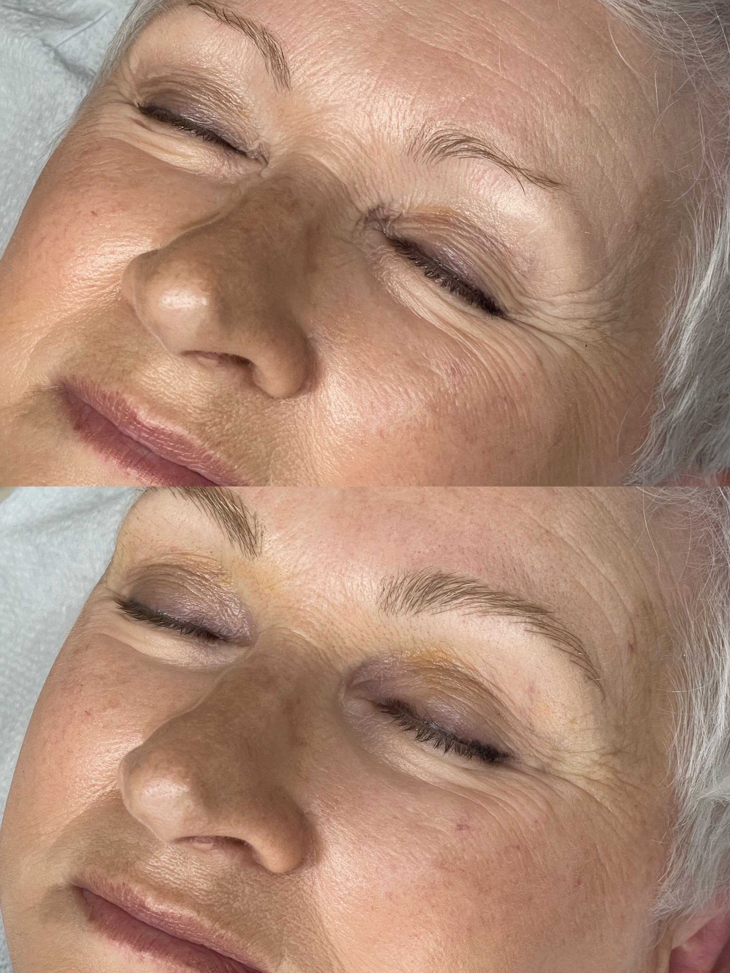 Before and after microblading, stacked comparison — the client's brows before treatment above, the result below