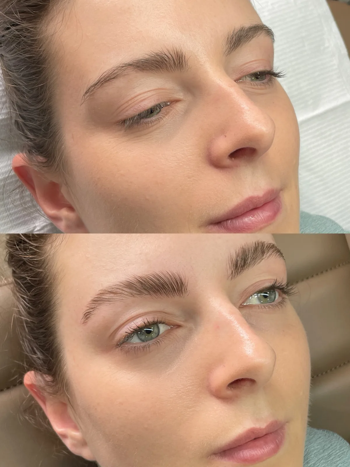 Before and after brow lift and tint: thin flat brow above, brushed up into a full feathered shape below