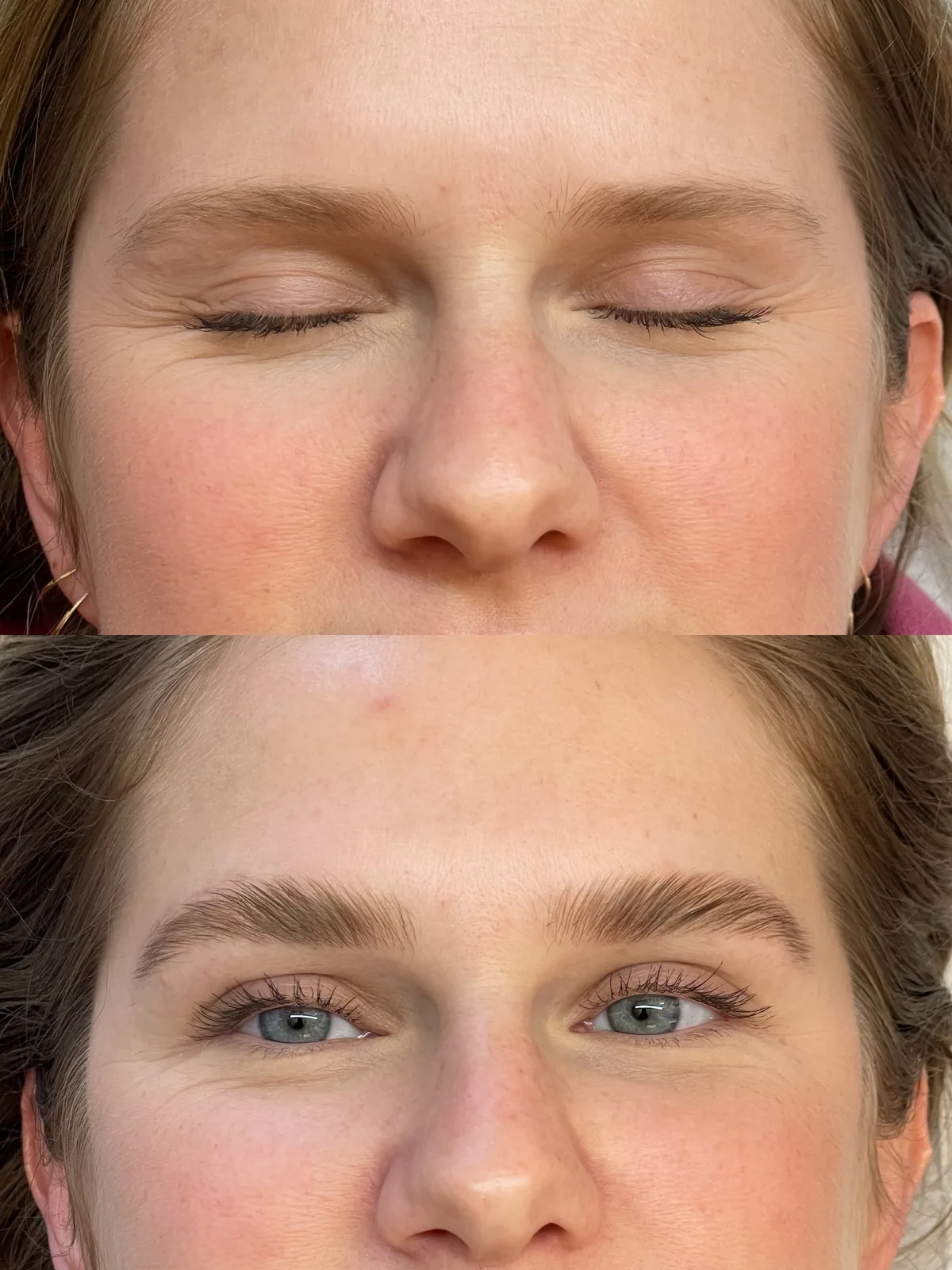 Before and after brow lift and tint on both brows, front view: flat pale brows above, lifted and tinted below with a more open eye area